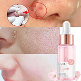 15 ML Hyaluronic Acid Pores Shrinking Essence Foundation